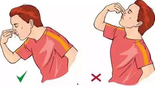 吃瓜流鼻血,揭秘瓜果中的“隐形杀手”